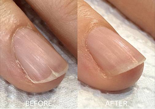 広島ネイルスクール｜アセトン不使用の完全オーガニック自爪育成ネイルケアLOHAS