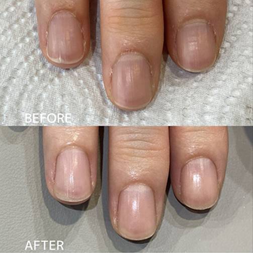 広島ネイルスクール｜アセトン不使用の完全オーガニック自爪育成ネイルケアLOHAS