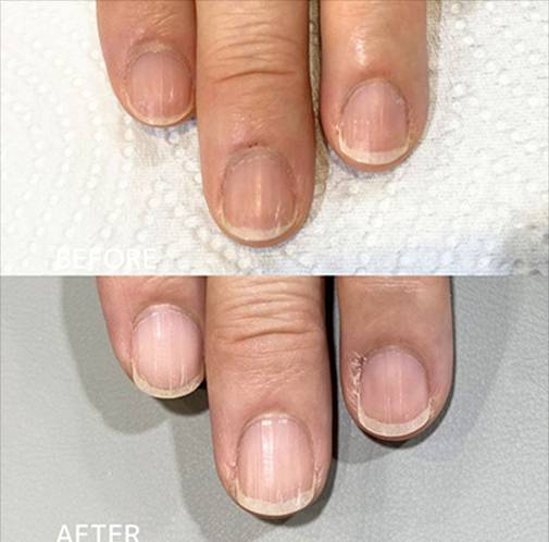 広島ネイルスクール｜アセトン不使用の完全オーガニック自爪育成ネイルケアLOHAS