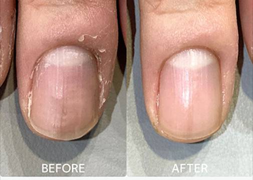 広島ネイルスクール｜アセトン不使用の完全オーガニック自爪育成ネイルケアLOHAS