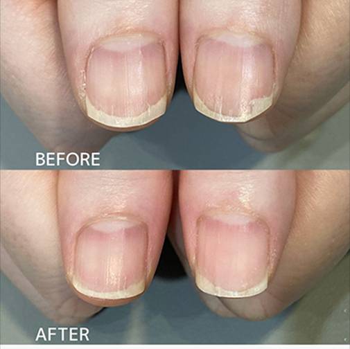 広島ネイルスクール｜アセトン不使用の完全オーガニック自爪育成ネイルケアLOHAS