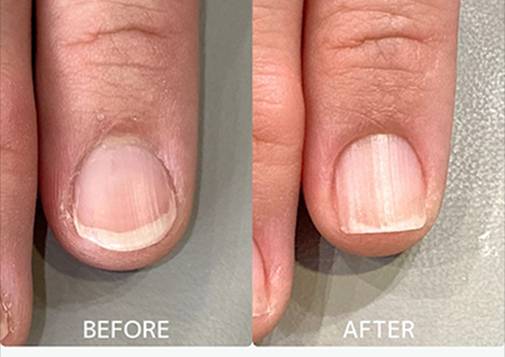 広島ネイルスクール｜アセトン不使用の完全オーガニック自爪育成ネイルケアLOHAS