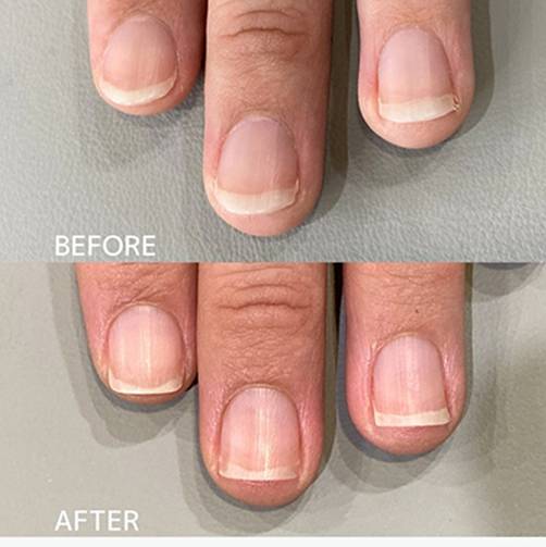 広島ネイルスクール｜アセトン不使用の完全オーガニック自爪育成ネイルケアLOHAS