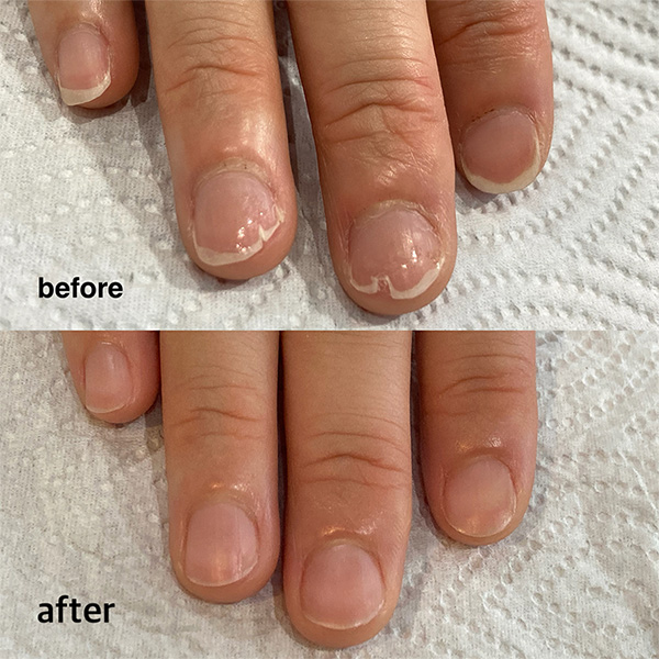 広島ネイルスクール｜アセトン不使用の完全オーガニック自爪育成ネイルケアLOHAS