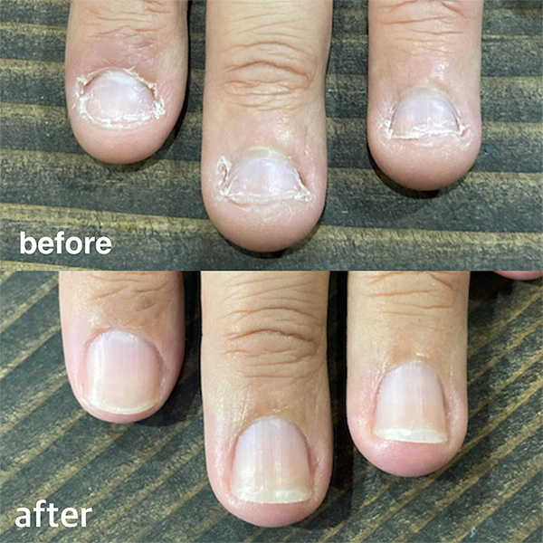 広島ネイルスクール｜アセトン不使用の完全オーガニック自爪育成ネイルケアLOHAS